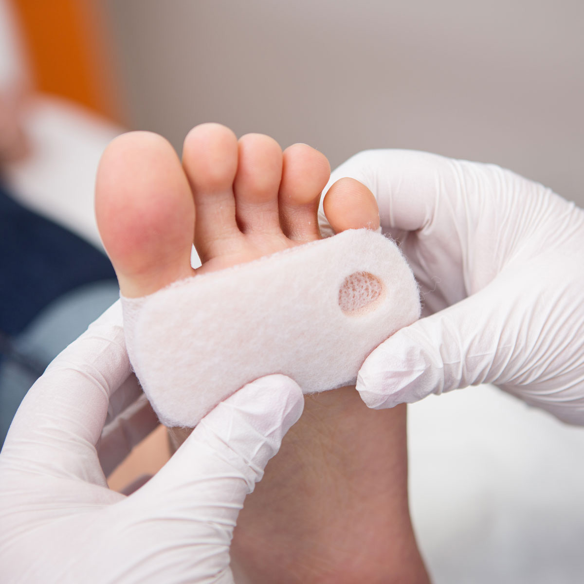 Lowering Blood Sugar: how to heal a diabetic foot sore
